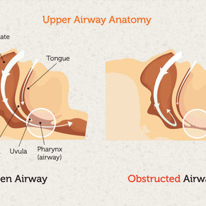 Sleep apnea - the experience, its symptoms, and its consequences
